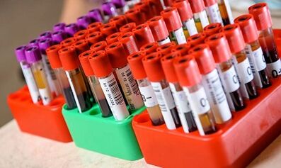 Dietas para bajar de peso según el tipo de sangre.